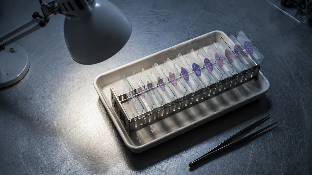 Endoscopio flexible colgado en un armario de secado, del tipo usado para el subgrupo endoscópico de esta cohorte GLP-1.